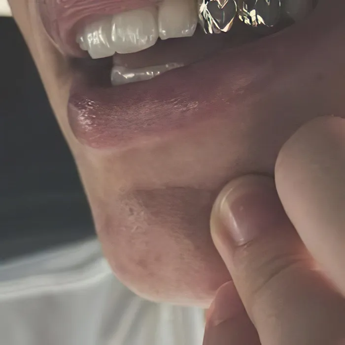 10K Gold Custom Double Heart Cutout Grillz Open Face Two Hearts Caps Bling Cartel Rings