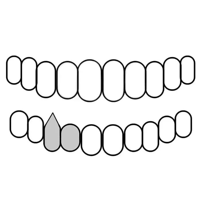 Bling Cartel 925 Silver Two Side Teeth Open Face Vampire Fangs CZ Double Caps Rings