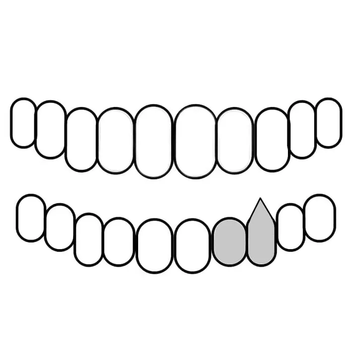 Bling Cartel 925 Silver Two Side Teeth Open Face Vampire Fangs CZ Double Caps Rings